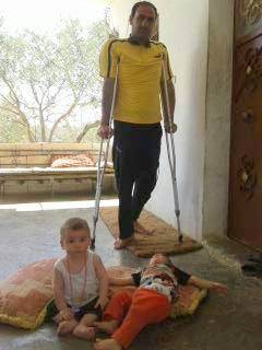 33-manafs-elder-brother-on-crutches-twins5